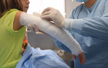 Ожоги первой степени