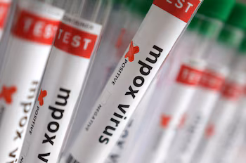 Стоковое Фото: Иллюстрация обозначенных пробирок "Положительный результат на вирус Mpox". 20 августа 2024 г. REUTERS/Дадо Рувич/