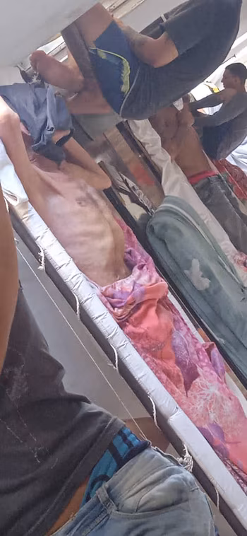 Недоедание в Лас-Мангасе, Баямо