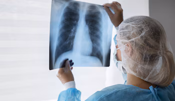 Всемирный день пневмонии – пневмония – Перу – новости – 12 ноября